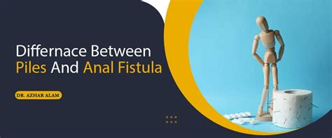 Difference Between Piles And Anal Fistula Dr Azhar Alam