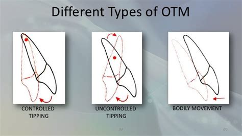 Biology Of Orthodontictooth Movement