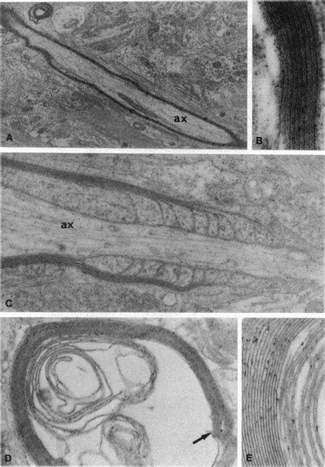 Transmission electron micrographs of myelinated axons and myelin-like ...