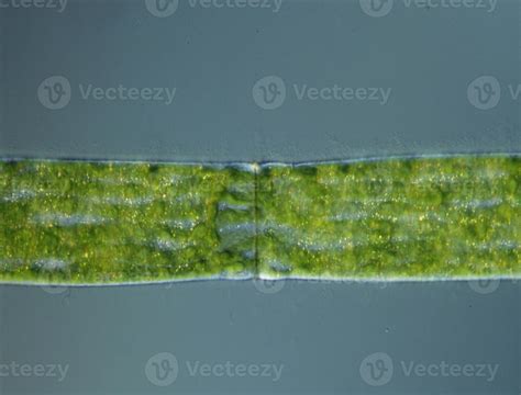 Green algae at high magnification under the microscope 12871651 Stock ...