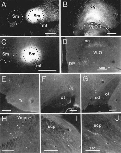 A B Darkfield Photomicrographs Of Coronal Sections Showing WGA HRP