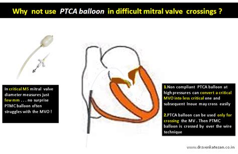 Mitral Valve Crossing Drsvenkatesan Md