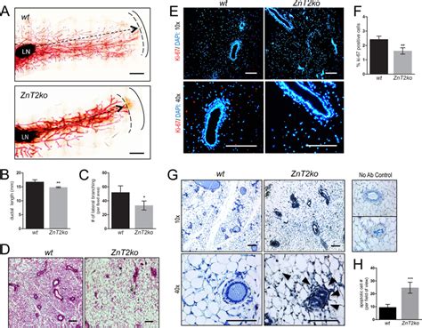 Mammary Gland Invasion And Expansion Is Impaired In Znt Null Mice