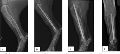 Table 1 From Evaluation Of Intramedullary Pinning Technique For