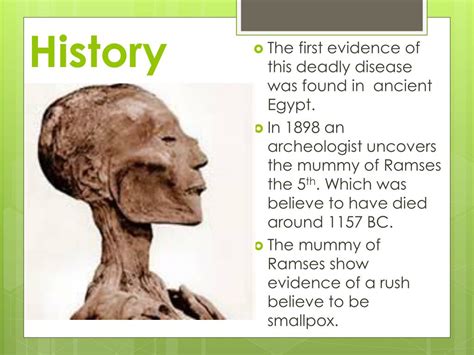 Ppt Smallpox Powerpoint Presentation Free Download Id5549858