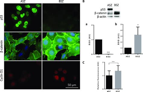 Expression Of P53 β Catenin And Ciclin D1 In Bcc Mice Lines A Download Scientific Diagram