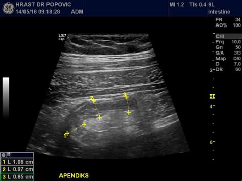 Ultrazvuk abdomena i male karlice ORDINACIJA HRAST DR POPOVIĆ