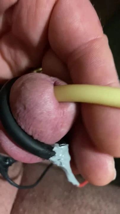 Electrocum Around Fr Catheter American Gay Bdsm Porn Xhamster