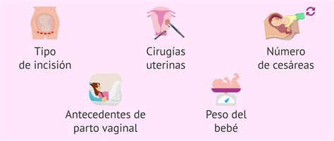 Factores A Tener En Cuenta Para Intentar Un Parto Vaginal Despu S De