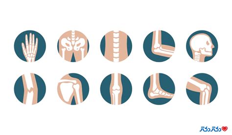 Types of orthopedic surgery in Iran 2024 - ADL Specialized Hospital