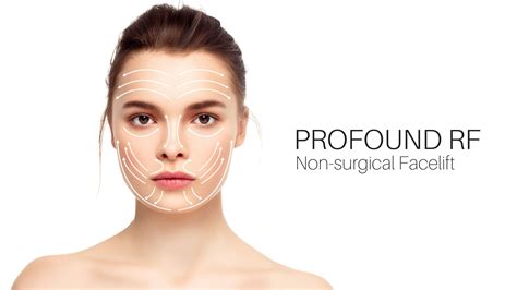 Profound Rf Non Surgical Lifting Tightening And Slimming