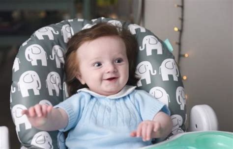 Un bambino di cinque mesi è nato con così tanti capelli da bloccare gli