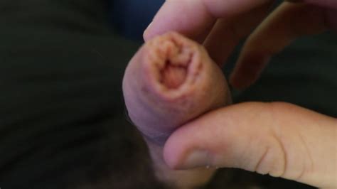 Playing With Foreskin 1080p HD Pornhub Gay