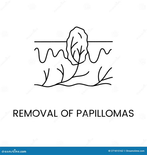 Removal of Papillomas Line Icon in Vector, Illustration of Papilloma in