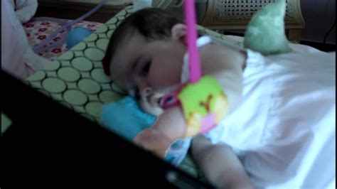 Spinal Muscular Atrophy Type 1 Amanda 10 Months Old YouTube