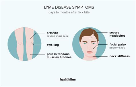 Lyme Disease Rash Symptoms