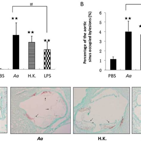 Atherosclerotic Plaque Formation In The Aortic Sinuses Of Apoe Shl Mice