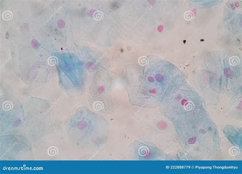 Histological Sample Squamous Epithelial Cells Under Microscope. Royalty ...