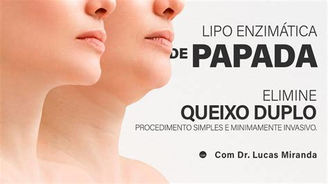 Lipo de papada acabe a papada de forma rápida e eficaz YouTube