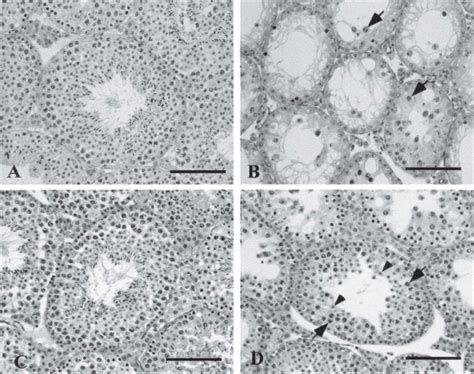 Photomicrographs Of Hematoxylin And Eosin Stained Sections Of Testis At