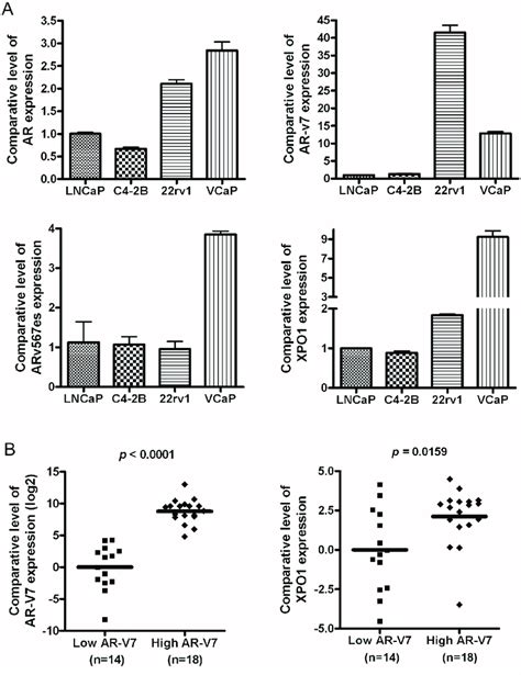 High Expression Of Ar Splice Variants Is Correlated With Over