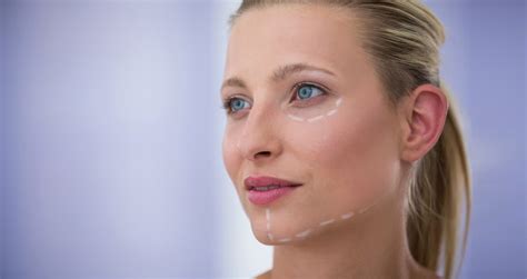 How To Reduce Swelling After Facelift Surgery