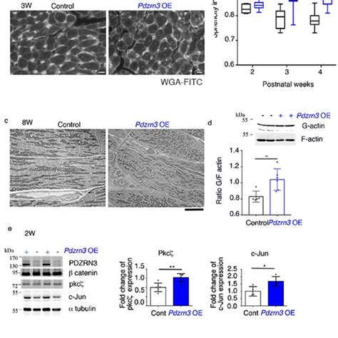 Cardiac Specific Overexpression Of Pdzrn3 Impairs Cardiomyocyte