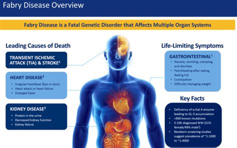 Fabry Disease - Symptoms and Treatment - iDiseases.com