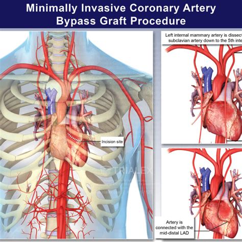 General Graphic And Medical Gallery Image Collection Trial Exhi