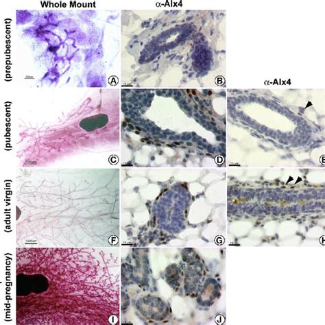 Alx Is Expressed During Postnatal Mammary Gland Development