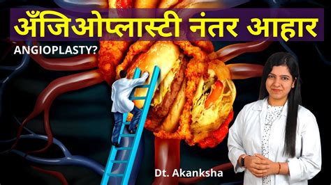 Diet After Angioplasty In Marathi Youtube