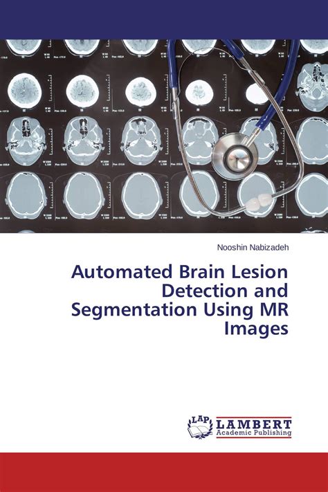 Automated Brain Lesion Detection And Segmentation Using MR Images 978