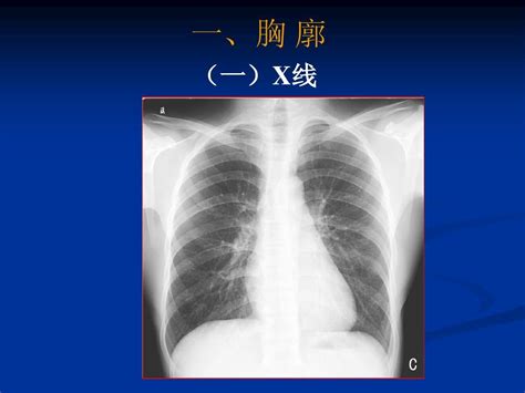 胸部影像解剖word文档在线阅读与下载无忧文档