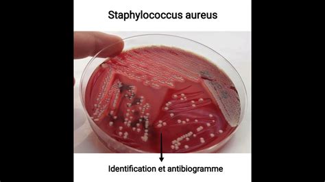 Staphylococcus Aureus Identification Et Antibiogramme YouTube