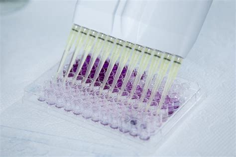 Cell Culture at the Cell Culture Laboratory Stock Photo - Image of ...