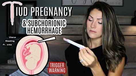 Iud Pregnancy Threatened Miscarriage Subchorionic Bleeding During Pregnancy Youtube