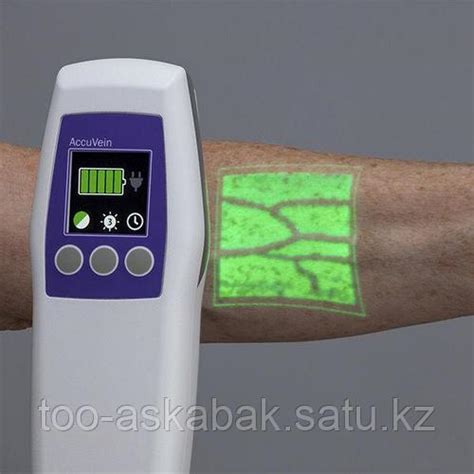 Веновизор аппарат для визуализации вен AccuVein AV500 (id 96135809)