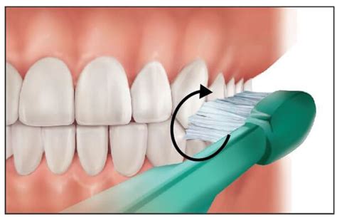 Brushing Techniques Focus Dentistry