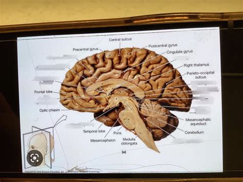 Neuro Lab Diagram Quizlet