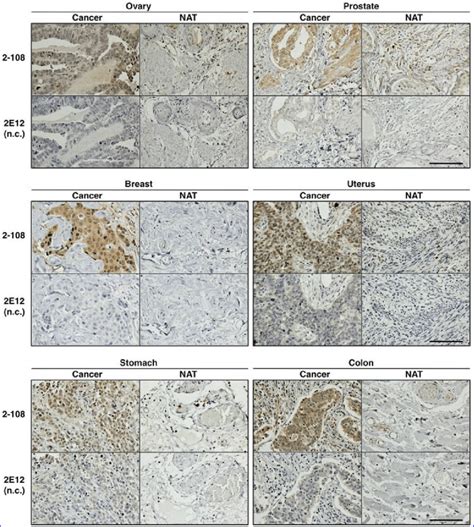 Ihc For Paraffin Embedded Tissues Paraffin Embedded Sections Of The