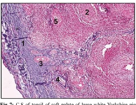 Figure 1 From Histomorphological Comparison Of Tonsil Of Large