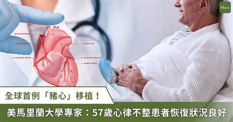 全球首例「豬心」移植！美馬里蘭大學專家：57 歲心律不整患者恢復良好 Heho健康 Line Today