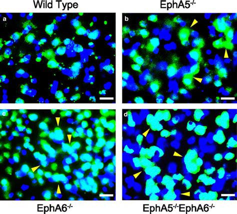 Double Immunostaining Showed The Presence Of Neuronal Clumps Neun In