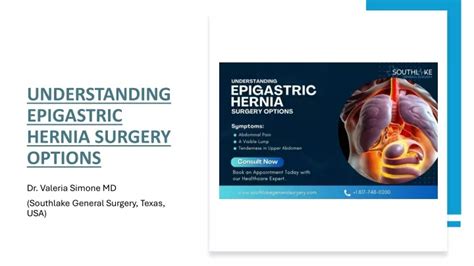 PPT Understanding Epigastric Hernia Surgery Options PowerPoint