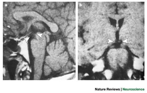 The Mammillary Bodies Two Memory Systems In One Nature Reviews