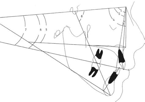 Angular Skeletal Measurements 1 Sna 2 Snb 3 Anb 4 Sn Ans Download Scientific