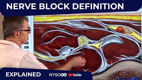 Nerve Block Definition Regional Anesthesia Crash Course With Dr