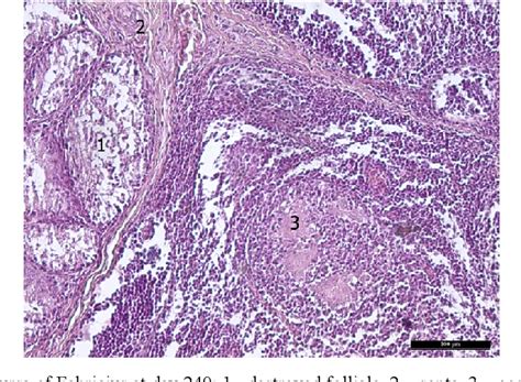 Figure 2 from Age-related histology of the bursa of Fabricius in bronze turkeys (Meleagris ...