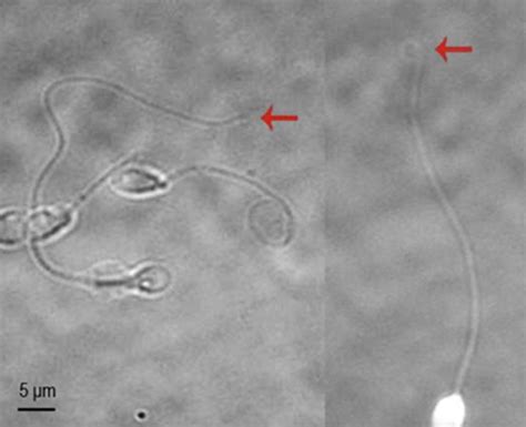 Potential Selection Of Genetically Balanced Spermatozoa Based On The