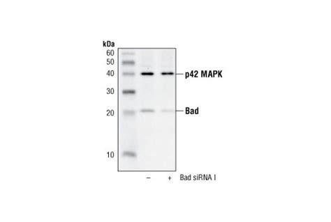 Bad Antibody Cell Signaling Technology